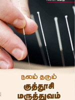 acupuncture